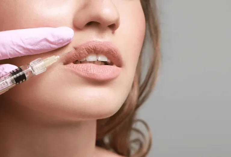 What to Expect from Lip Filler Treatments?
